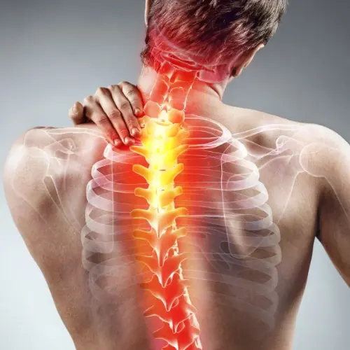 Neuropathic Pain